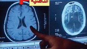 المنطقة المسؤولة عن الكذب فى جسم الانسان..