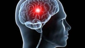 40 ألف إصابة بالجلطة الدماغية وسط الجزائريين سنويا