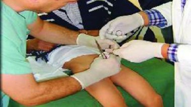 Sur ordonnance du ministère de la Santé : les médecins généralistes interdits de faire les circoncisions