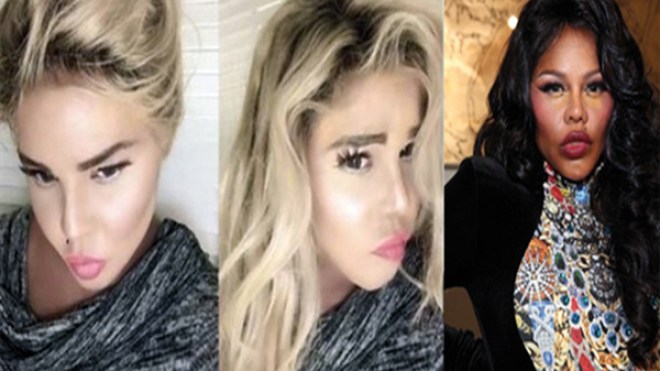 مغنية راب عالمية تغيّر لون بشرتها بالكامل!