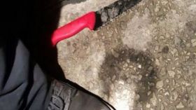 إصابة مستوطن في عملية طعن شمال القدس المحتلة