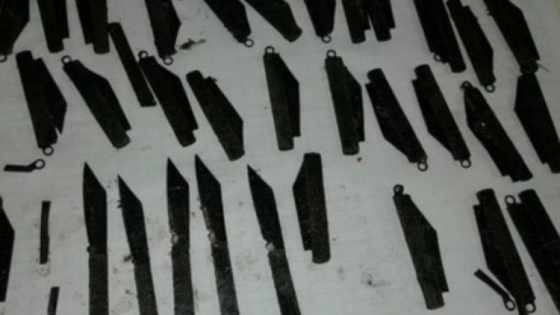 استخراج 40 سكينا من بطن مريض هندي