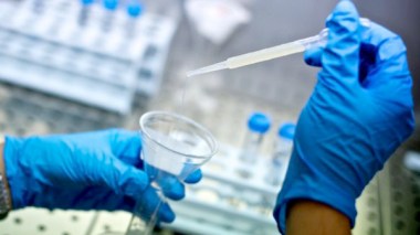 Patients With Cancer Pay 10.000 DZD To Freeze Semen