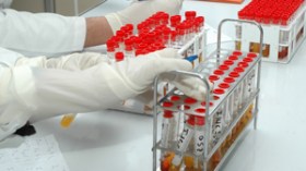 توزيع محاليل كشف الدم على مستشفيات دون إخضاعها للتأشير المخبري