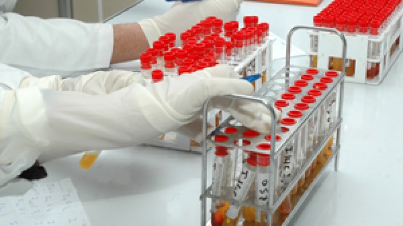 توزيع محاليل كشف الدم على مستشفيات دون إخضاعها للتأشير المخبري