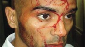 “لن أسامح المصريين لأن همجيتهم قلة احترام للجزائر”