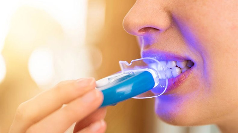 “ليزر” لتبييض الأسنان “فاسد” يباع في أسواق سطيف