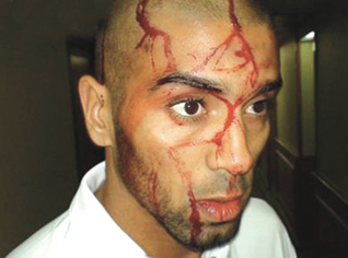 Egyptian Football Federation Vice â€“President admits the attack on the Algerian bus