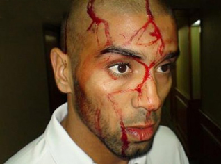 FIFA to force the Egyptian squad to play outside Cairo