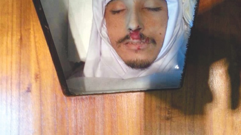 وفاة أول من اكتشف مخبأ القذافي بإحدى المصحات الفرنسية