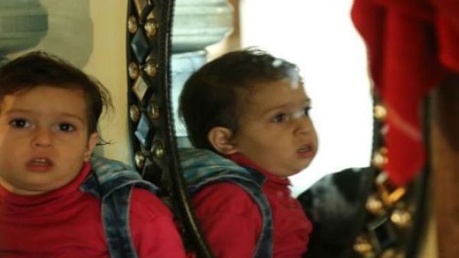 الرضيعة البالغة ليمار حالة أعجزت الأطبّاء!