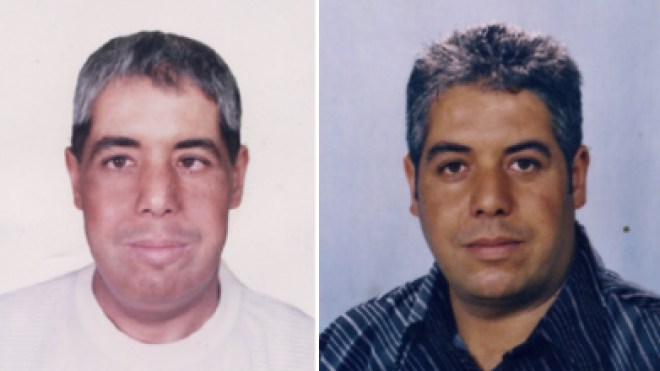 نظارات وكمامات تتسبب في إصابة وجه مواطن جزائري بالسرطان