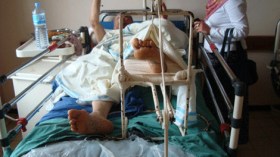 المسن الذي يتعرض لكسر العظام في الجزائر مصيره الموت