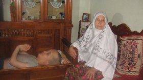 مأساة طفل برأس كبير وزنه أكبر من جسمه