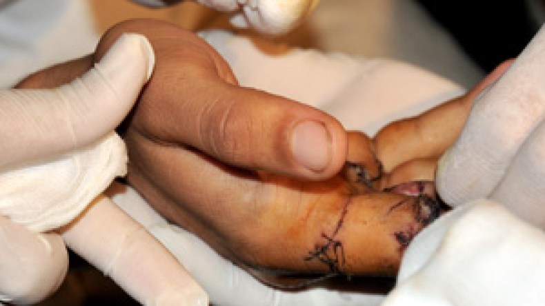 الأطباء العرب يناقشون سحب الأمانة العامة للإتحاد من مصر