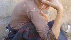 مرض غريب يأتي على وجه سيدة فقيرة والموت يهددها في أية لحظة