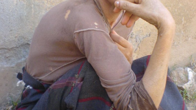 مرض غريب يأتي على وجه سيدة فقيرة والموت يهددها في أية لحظة