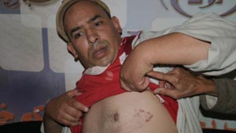 طعنة سكين اخترقت قلبه فأفقدته البصر وقضت على شبابه