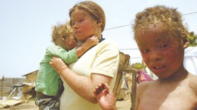 أمير إماراتي تكفل بأفراد العائلة الذين يكسوهم جلد الثعابين