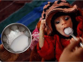 Malnutrition to hit Algeria in the coming years