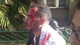 الضرب على الرأس.. وصناعة اليأس!