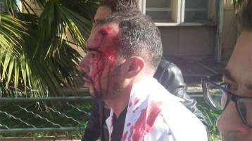 الضرب على الرأس.. وصناعة اليأس!