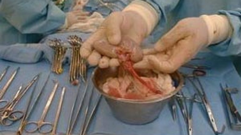 حوالي 500شكوى ضد أطباء ارتكبوا أخطاء طبية