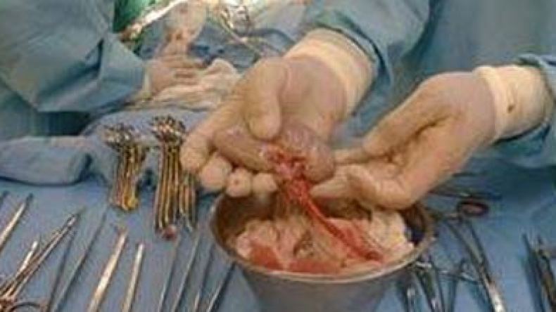 مصالح الأمن تحقق في مآسي وقعت في عيادة خاصة بقسنطينة