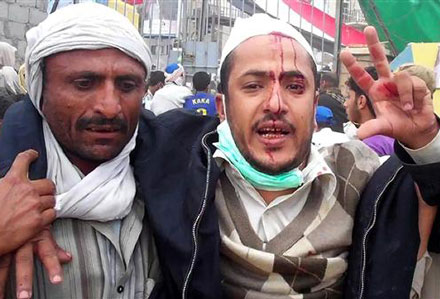 Yémen : nouvelles défections au sein de l'armée