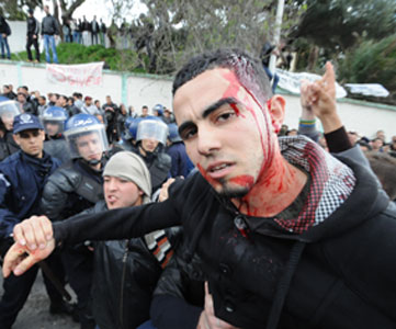 Grève des étudiants : les confrontations entre étudiants et forces de l’ordre ont fait plusieurs blessés