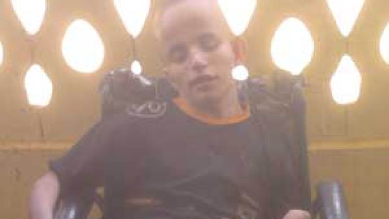 محمد‮.. ‬معاناة‮ ‬عمرها‮ ‬15‮ ‬سنة