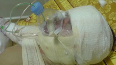 Grèves répétitives des médecins : la vie de 250 000 malades en danger