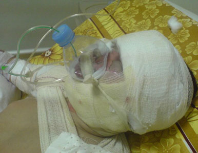 Grèves répétitives des médecins : la vie de 250 000 malades en danger