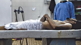 جثث مكدسة منذ سنوات بمصلحة حفظ الجثث بمستشفى البليدة