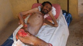 عبد الله يفارق الحياة بمستشفى المسيلة