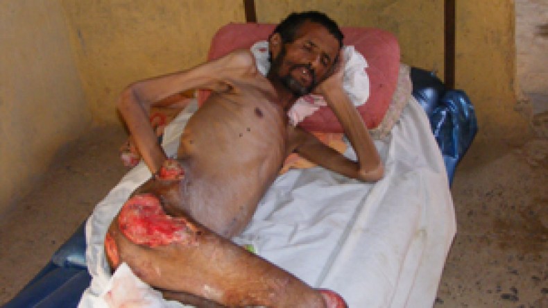 عبد الله يفارق الحياة بمستشفى المسيلة