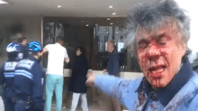 نكّاز يتعرض لاعتداء بباريس