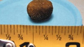 الإكثار من الملح من أجل عيون “الذكر”.. والحليب ومشتقاته لإنجاب “البنت”