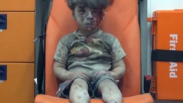 “فضحتنا” يا عمران!