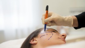 نساء ورجال يتزاحمون على عمليات التجميل والحقن السرية