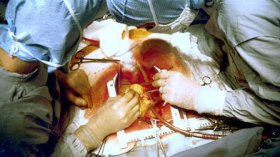 جراحة القلب في الجزائر أفلست مستشفيات جامعية بباريس