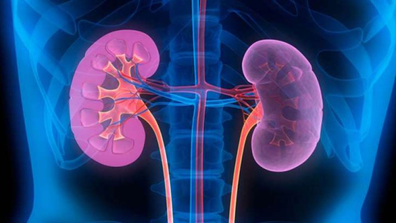 7 علامات تدل على إصابتك بحصى الكلى
