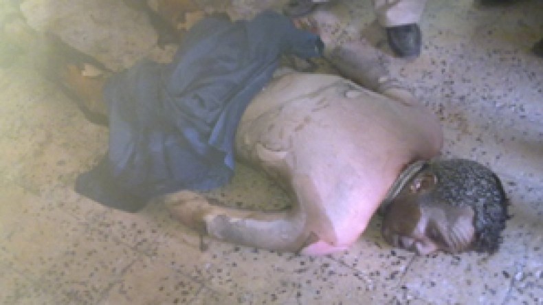 وفاة‭ ‬الشاب‭ ‬عبد‭ ‬الله‭ ‬الذي‭ ‬أحرق‭ ‬نفسه‭ ‬بورڤلة