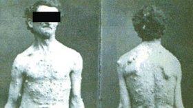 ضحية زواج تقليدي تستغيث:خدعني بجسمه المشوه وأنجبت منه أربعة أطفال معوقين