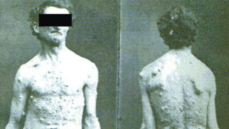 ضحية زواج تقليدي تستغيث:خدعني بجسمه المشوه وأنجبت منه أربعة أطفال معوقين