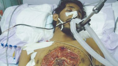 Israël emploie des armes prohibées contre les ghazaouis