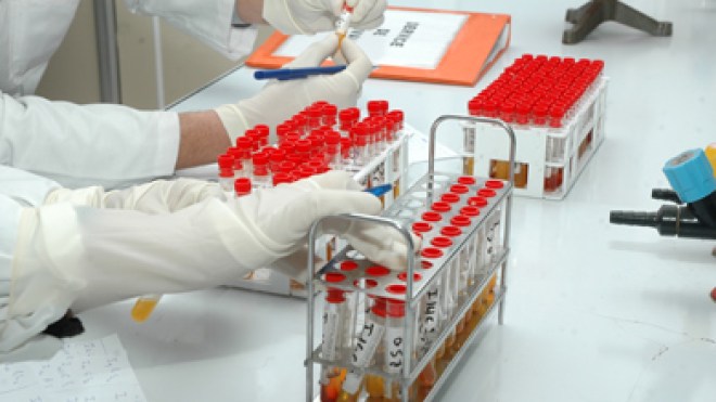 تعفن مليون ونصف مليون جرعة لقاح أطفال