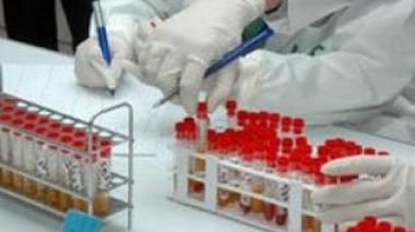 Reagents shortage in Algeria Pasteur Institute
