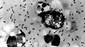 Un cas de peste bubonique détecté en Mongolie Intérieure
