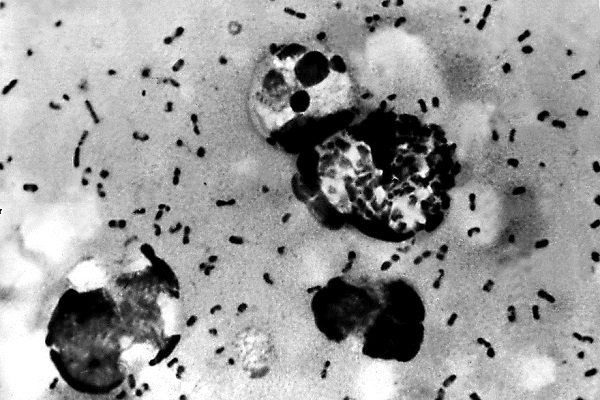 Un cas de peste bubonique détecté en Mongolie Intérieure